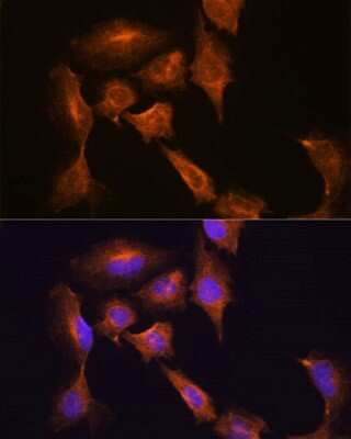 Immunocytochemistry/ Immunofluorescence: HOOK3 Antibody - Azide and BSA Free [NBP3-05070]