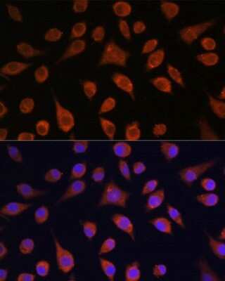 Immunocytochemistry/ Immunofluorescence: HOOK3 Antibody - Azide and BSA Free [NBP3-05070]