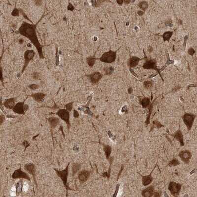 Immunohistochemistry-Paraffin: HOOK3 Antibody [NBP1-81743]