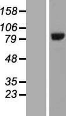 Western Blot: HOOK3 Overexpression Lysate [NBL1-11660]