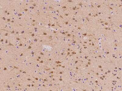 Immunohistochemistry-Paraffin: HOP Antibody [NBP2-97809]