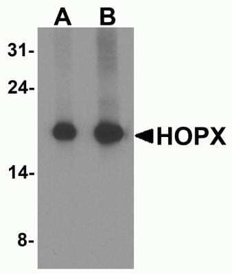 Western Blot: HOP AntibodyBSA Free [NBP2-82093]