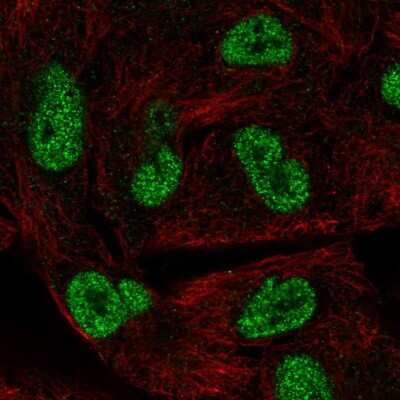 Immunocytochemistry/ Immunofluorescence: HORMAD1 Antibody [NBP2-54973]