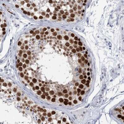 Immunohistochemistry-Paraffin: HORMAD1 Antibody [NBP1-85401]
