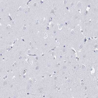 Immunohistochemistry-Paraffin: HORMAD1 Antibody [NBP1-85401]