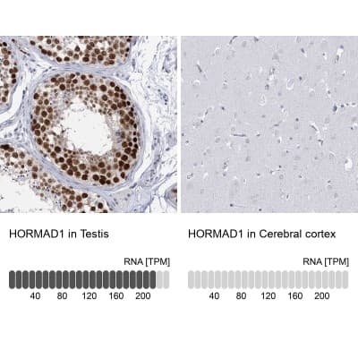 Immunohistochemistry-Paraffin: HORMAD1 Antibody [NBP1-85401]