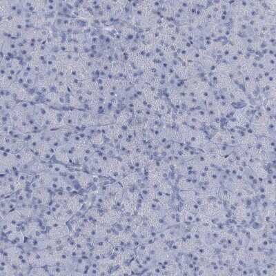 Immunohistochemistry-Paraffin: HORMAD1 Antibody [NBP1-85401]