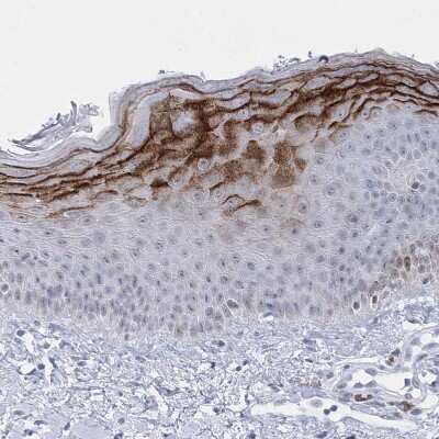 Immunohistochemistry-Paraffin: HORMAD1 Antibody [NBP1-85401]