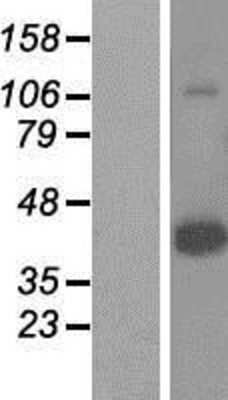 Western Blot: HORMAD1 Overexpression Lysate [NBP2-06072]