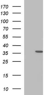 Western Blot: HORMAD2 Antibody (OTI3E4)Azide and BSA Free [NBP2-72416]