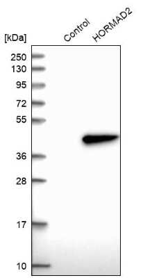 Western Blot: HORMAD2 Antibody [NBP1-82724]