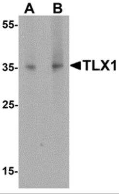 Western Blot: HOX11 AntibodyBSA Free [NBP2-81887]