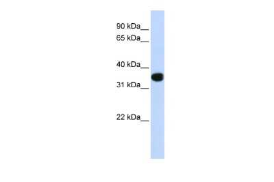 Western Blot: HOX11 Antibody [NBP2-84075]