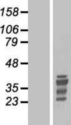 Western Blot: HOX11 Overexpression Lysate [NBP2-10462]