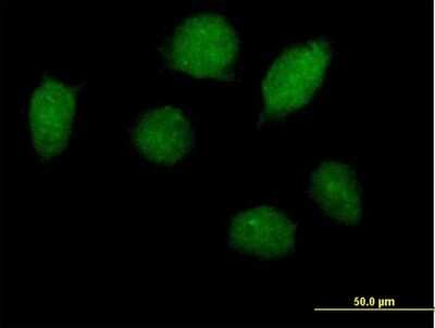 Immunocytochemistry/ Immunofluorescence: HOXA1 Antibody [H00003198-B01P]