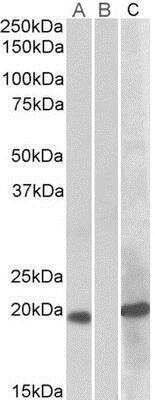 Western Blot: HOXA1 Antibody [NBP1-49835]