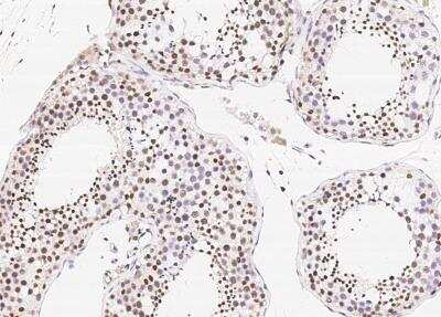 Immunohistochemistry-Paraffin: HOXA10 Antibody [NBP3-06103]