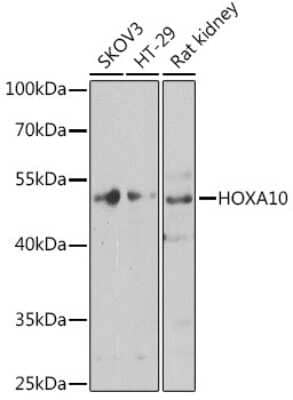 Western Blot: HOXA10 AntibodyBSA Free [NBP3-04877]