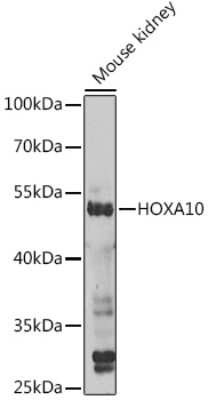 Western Blot: HOXA10 AntibodyBSA Free [NBP3-04877]