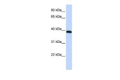 Western Blot: HOXA10 Antibody [NBP3-10289]