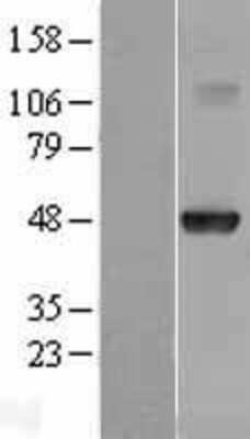 Western Blot: HOXA10 Overexpression Lysate [NBL1-11664]