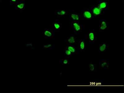 Immunocytochemistry/ Immunofluorescence: HOXA11 Antibody (5A3) [H00003207-M08]