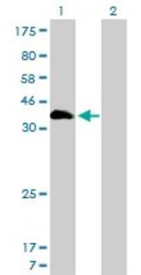 Western Blot: HOXA11 Antibody (7E12) [H00003207-M01]