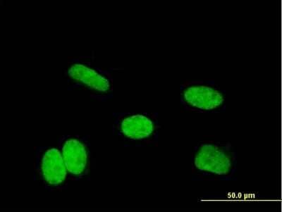 Immunocytochemistry/ Immunofluorescence: HOXA11 Antibody (7F8) [H00003207-M07]