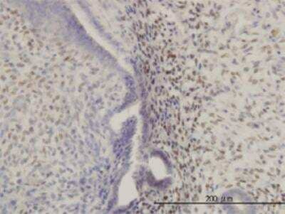 Immunohistochemistry-Paraffin: HOXA11 Antibody (8B8) [H00003207-M05]