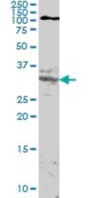 Western Blot: HOXA11 Antibody (8B8) [H00003207-M05]