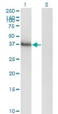 Western Blot: HOXA11 Antibody (8B8) [H00003207-M05]