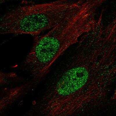 Immunocytochemistry/ Immunofluorescence: HOXA11 Antibody [NBP2-58894]