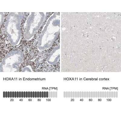 Immunohistochemistry-Paraffin: HOXA11 Antibody [NBP1-83233]