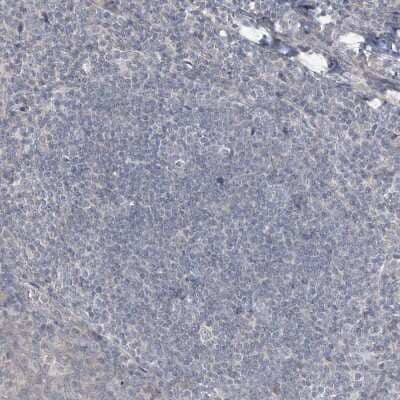 Immunohistochemistry-Paraffin: HOXA11 Antibody [NBP1-83233]