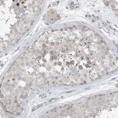 Immunohistochemistry-Paraffin: HOXA11 Antibody [NBP1-83233]