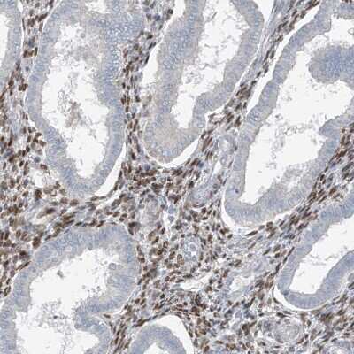 Immunohistochemistry-Paraffin: HOXA11 Antibody [NBP1-83233]