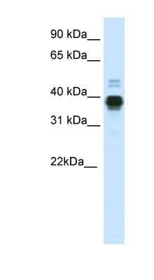 Western Blot: HOXA11 Antibody [NBP1-80228]