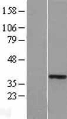 Western Blot: HOXA11 Overexpression Lysate [NBL1-11665]