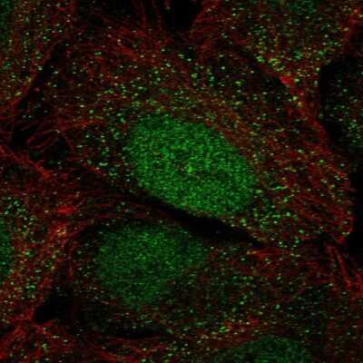 Immunocytochemistry/ Immunofluorescence: HOXA2 Antibody [NBP2-58865]