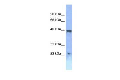 Western Blot: HOXA2 Antibody [NBP2-83052]