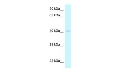 Western Blot: HOXA2 Antibody [NBP2-83053]