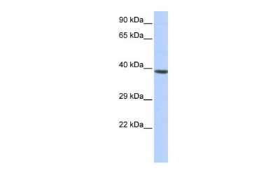 Western Blot: HOXA2 Antibody [NBP2-83054]