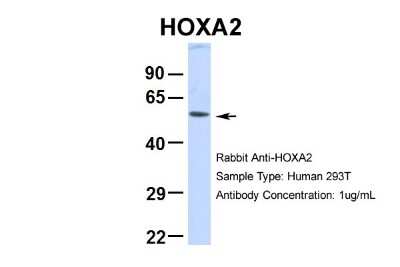 Western Blot: HOXA2 Antibody [NBP2-83054]
