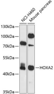 Western Blot: HOXA2 AntibodyBSA Free [NBP3-04843]