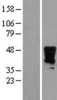 Western Blot: HOXA2 Overexpression Lysate [NBL1-11666]