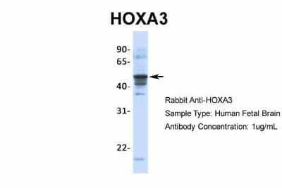 Western Blot: HOXA3 Antibody [NBP2-85008]