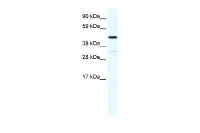 Western Blot: HOXA3 Antibody [NBP2-85062]