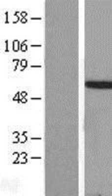 Western Blot: HOXA3 Overexpression Lysate [NBL1-11667]