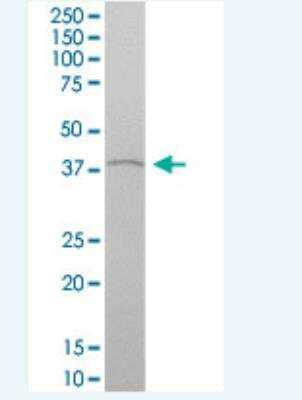 Western Blot: HOXA4 Antibody [H00003201-B01P-50ug]