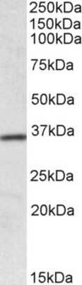 Western Blot: HOXA4 Antibody [NBP1-52039]